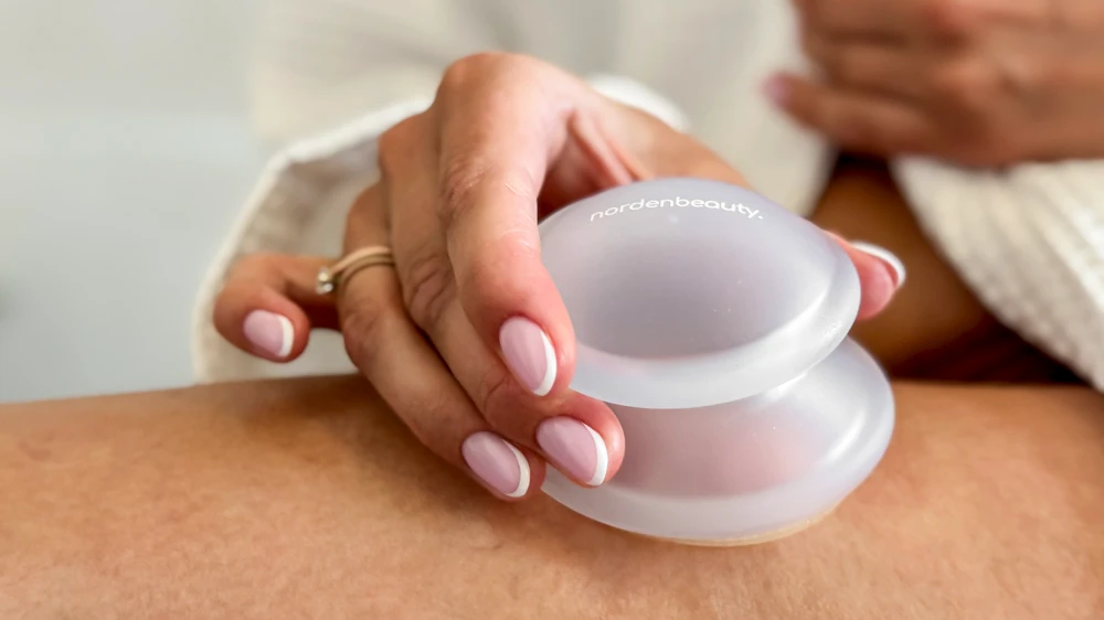 Cupping therapy on legs for lipedema swelling