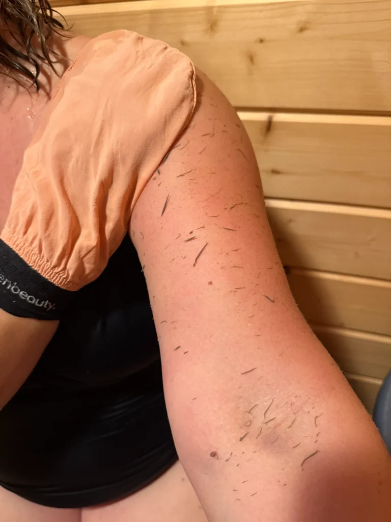 Image #1 from Hilkka V.